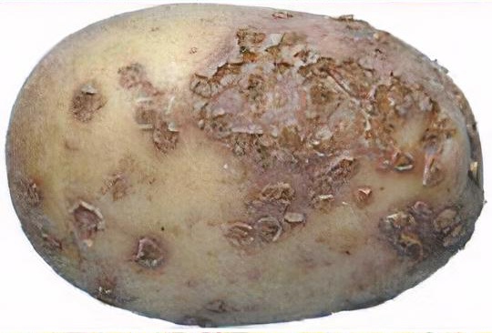 Potato powdery scab